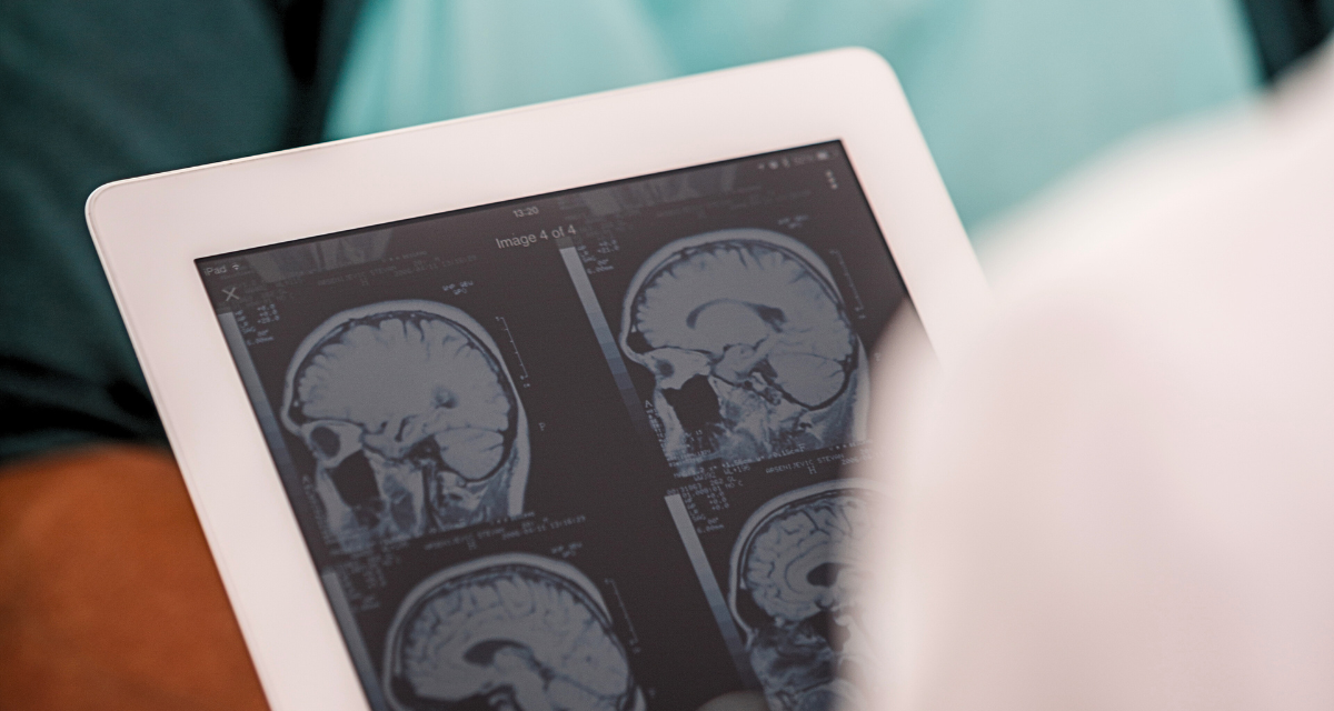 HEADER IMAGE Understanding Your MRI Results